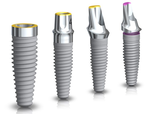 Dental Implants
